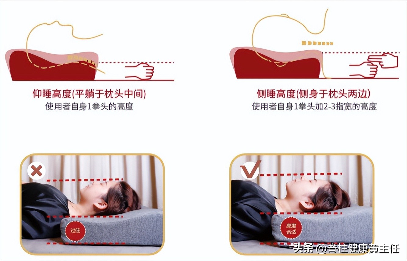 颈椎病曲度变直后如何矫正,颈椎生理曲度变直怎么治疗和恢复