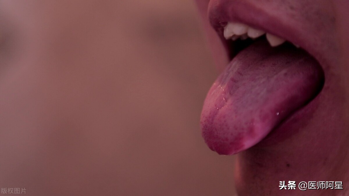 中医治疗湿疹效果好吗,湿疹看中医还是西医好