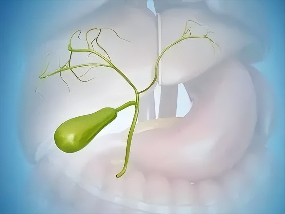 胆囊有罪，真的要杀无赦吗？