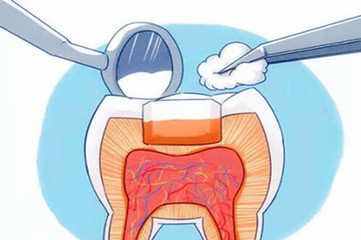 洗完牙后牙齿敏感酸痛正常吗,镶完牙以后牙齿特别敏感怎么回事