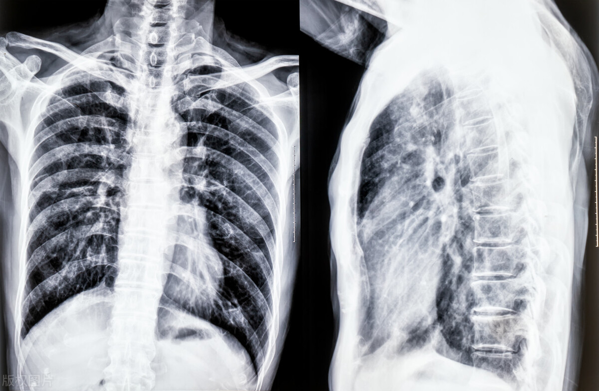 经常胸口疼痛要警惕四种病,经常胸前区疼痛有一分钟左右