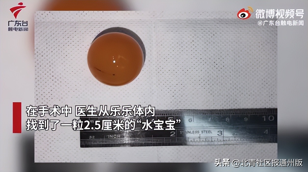 一小孩误食磁力球,幼童误食28颗磁力珠被救