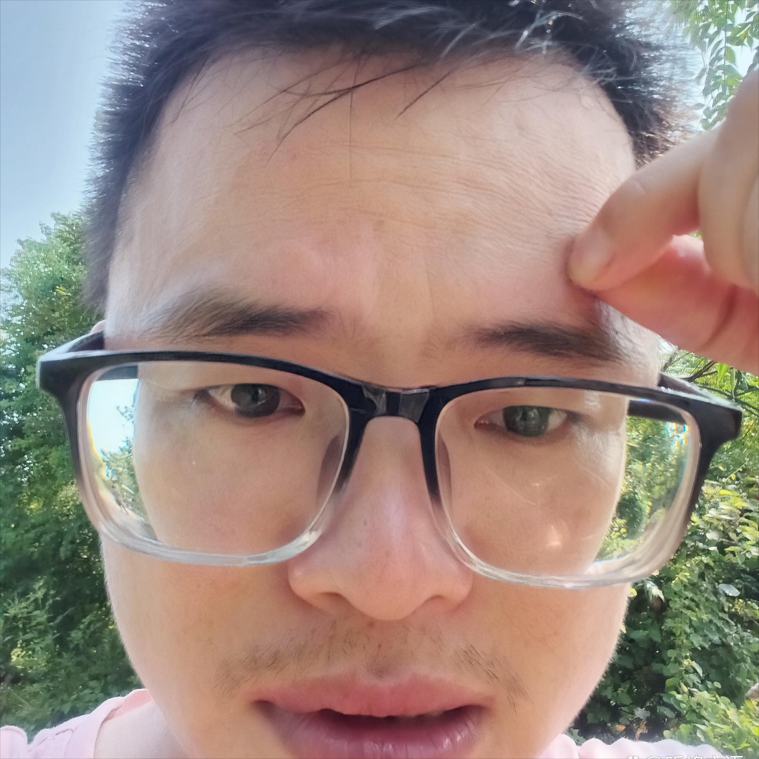 第一次被蜜蜂蛰是怎样的感觉,额头被蜜蜂蛰了没什么大的感觉