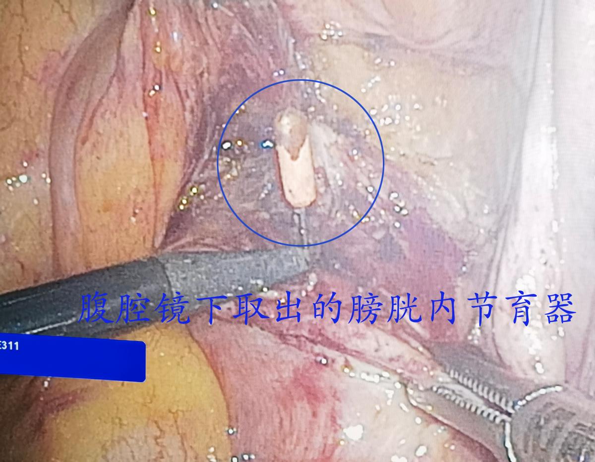 哈医大一院群力妇科,哈医大一院群力分院妇产科