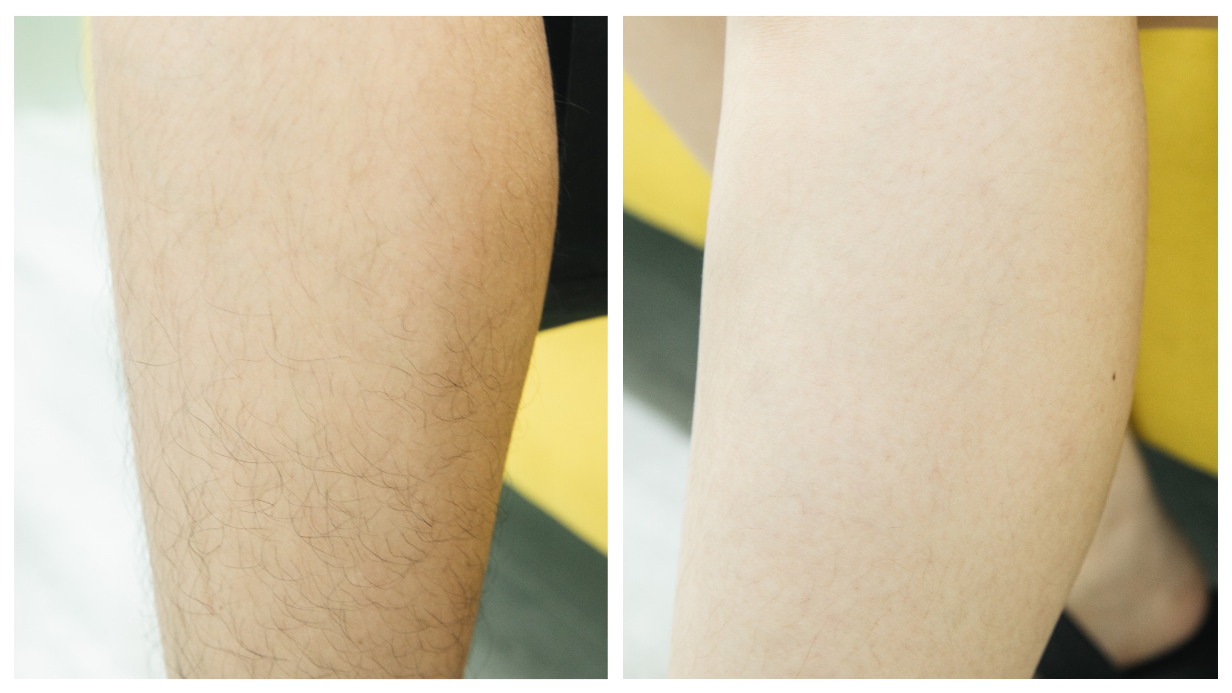 脱毛仪到底是黑科技还是智商税,脱毛仪是智商税还是高科技神器