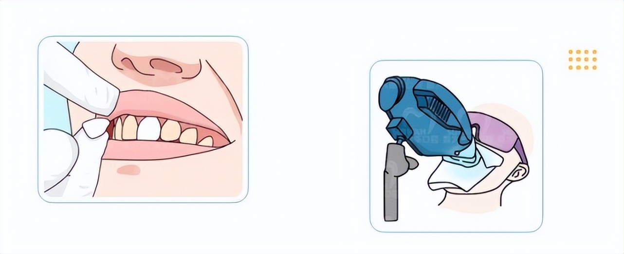 为什么天天刷牙牙齿还有黑斑,经常用美白牙膏为什么还是牙黄
