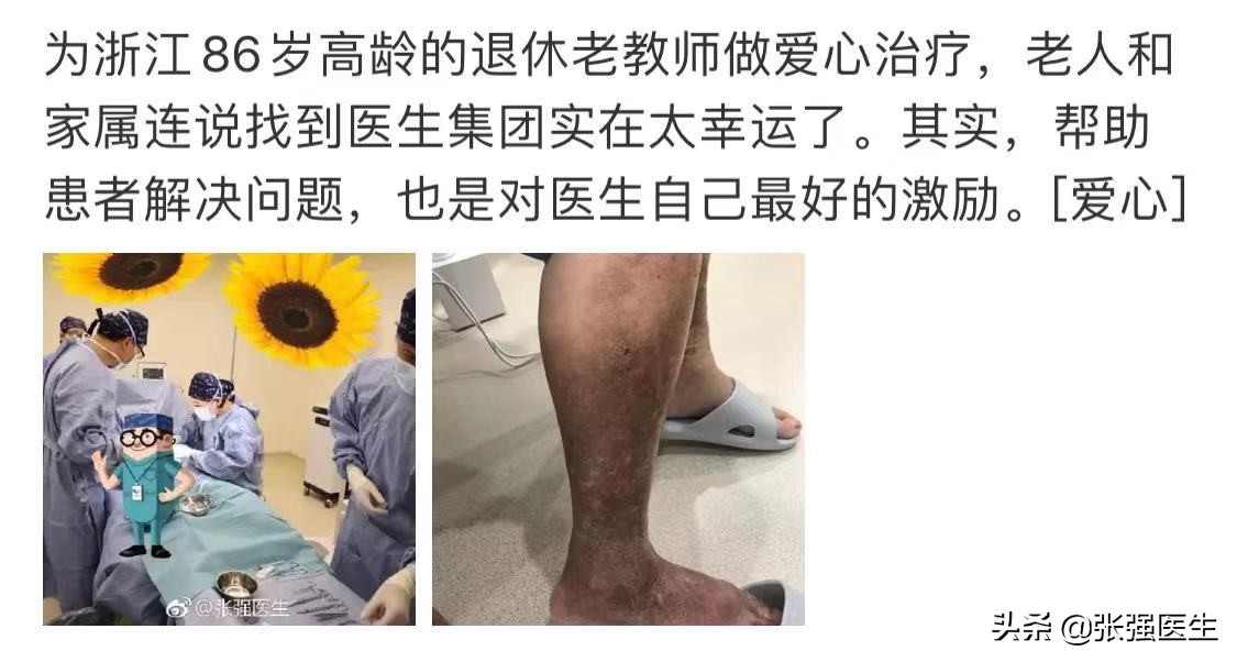 60多岁老人小腿静脉曲张怎么治疗,老人静脉曲张腿肿挂什么科