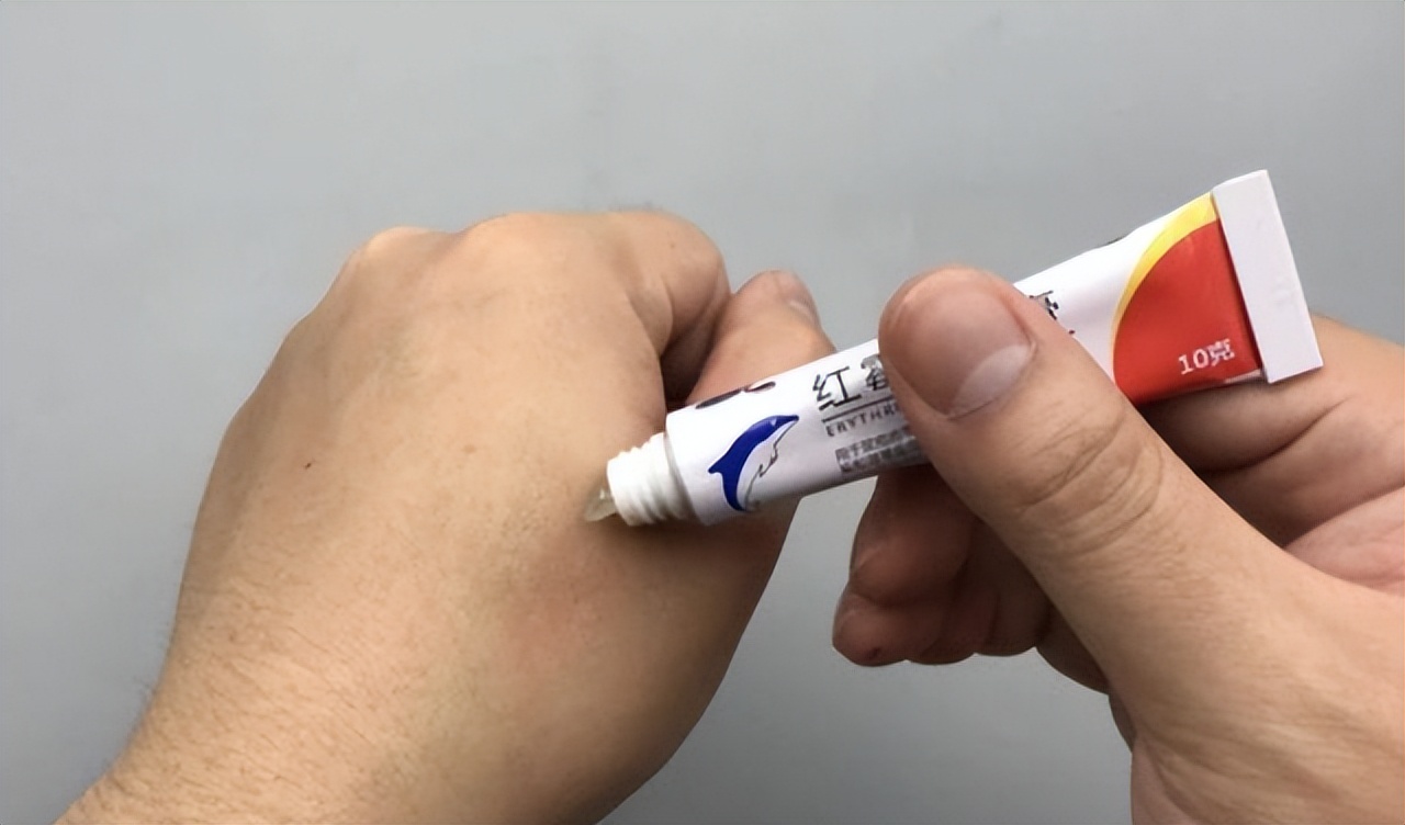 皮肤长“小肉球”是怎么回事，可以抠掉吗？该如何去除？望知晓