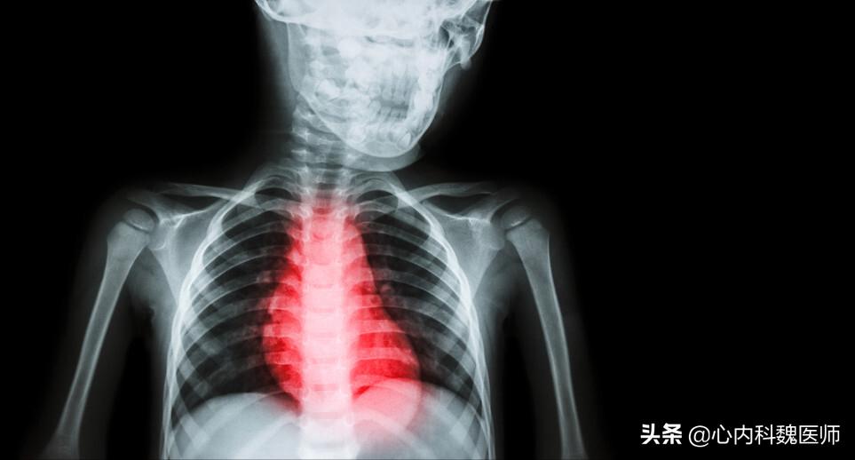 控制冠心病的药,治疗心血管疾病的药物哪个最好