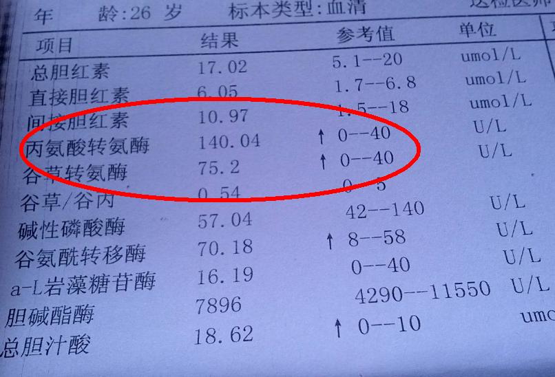 体检肝功能转氨酶偏高怎么快速降,转氨酶偏高怎么样能让体检通过呢