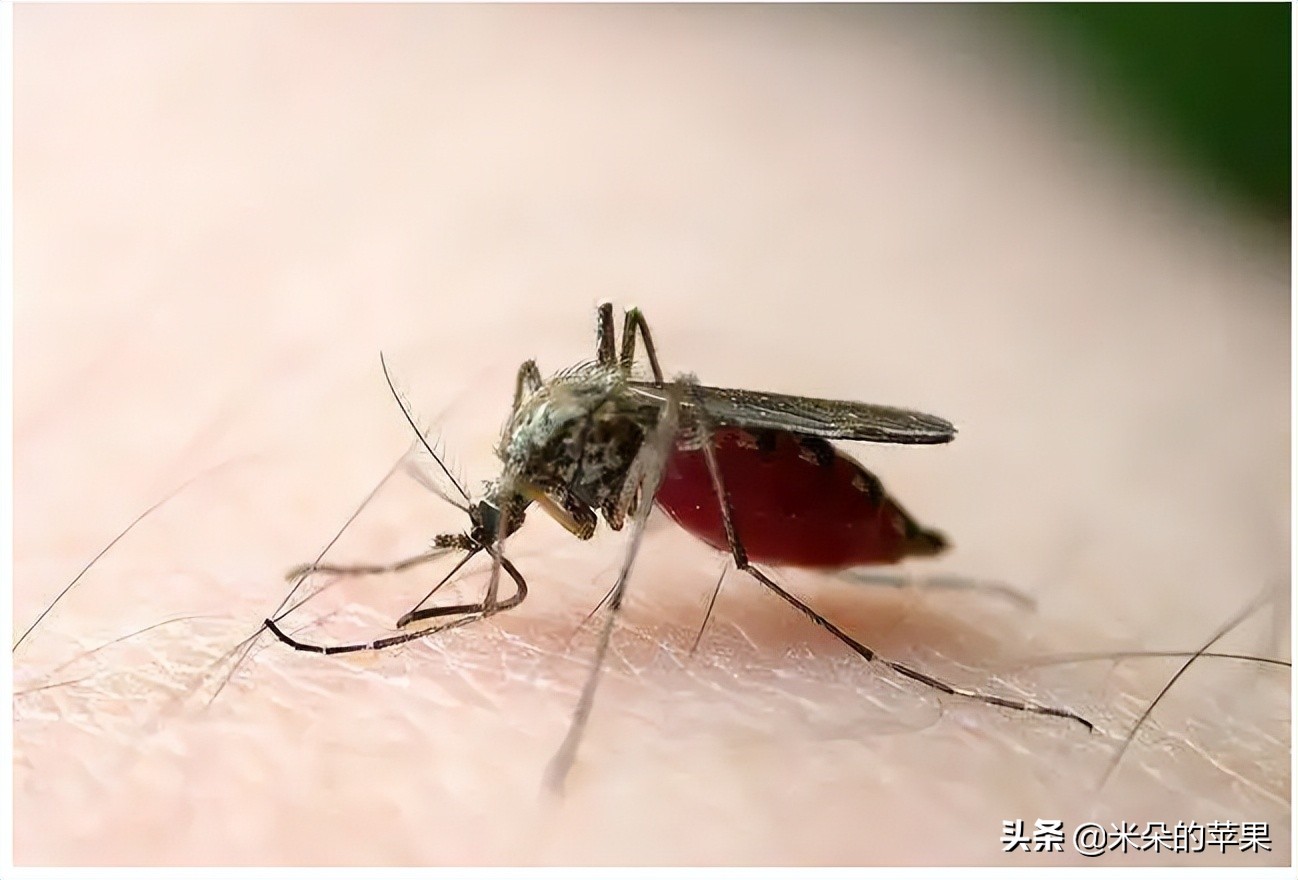 孩子被蚊子咬了很痒怎么办,孩子被蚊子咬痒得厉害怎么办