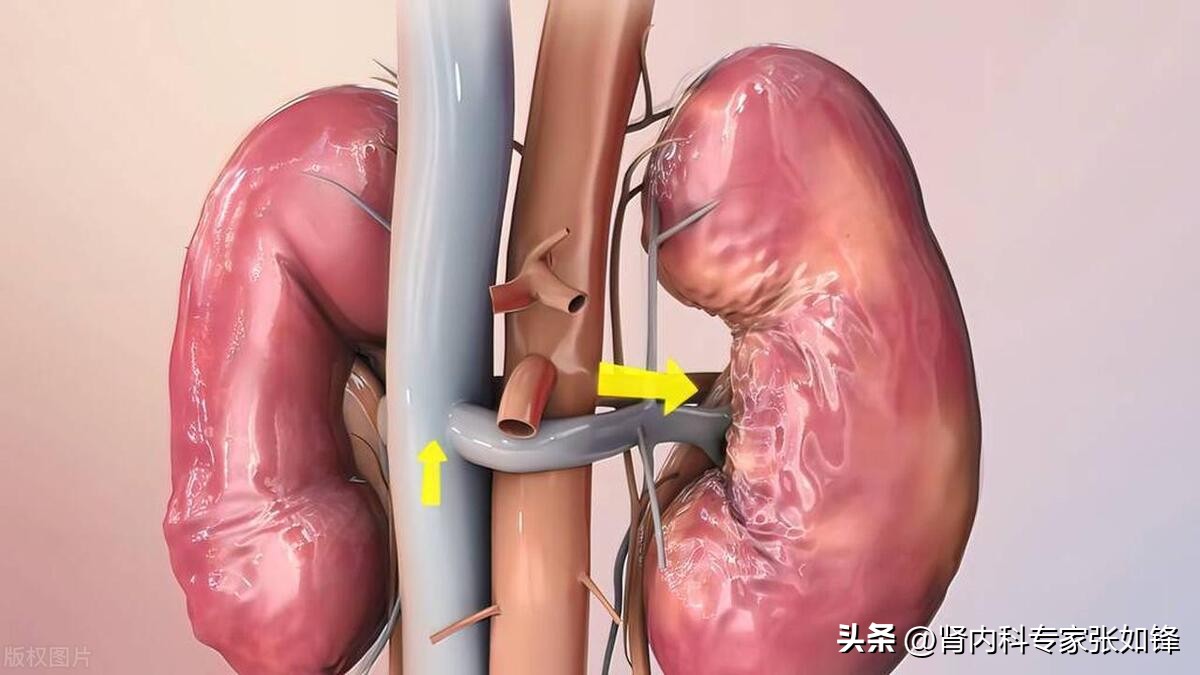 肾病尿毒症能活多久取决于什么,你的肾好不好