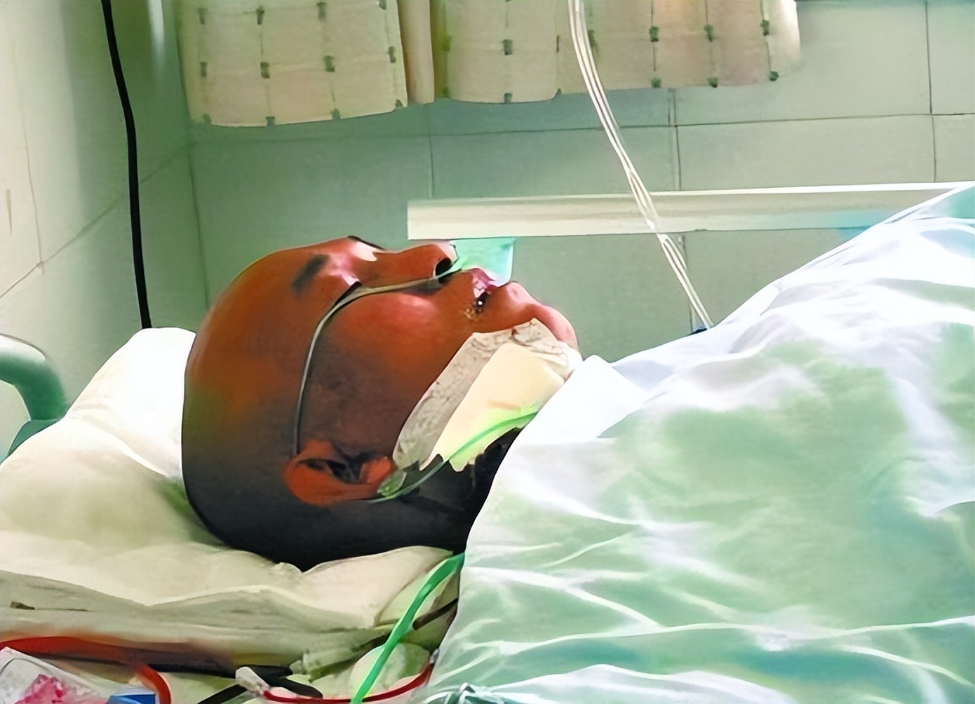 云南男子被妻子按摩到吐血，去医院检查，医生：你脑袋里插了把刀