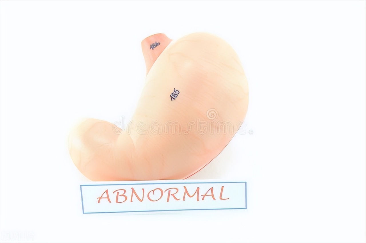 李东垣治腹泻的药方,李东垣的弟子罗天益