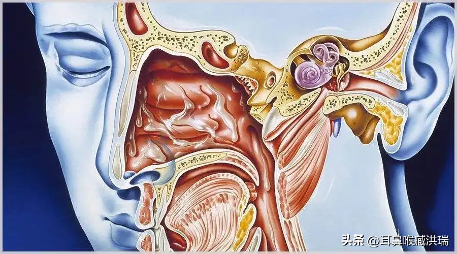 耳鼻喉科鼻窦炎知识,耳鼻喉科科普文章大全