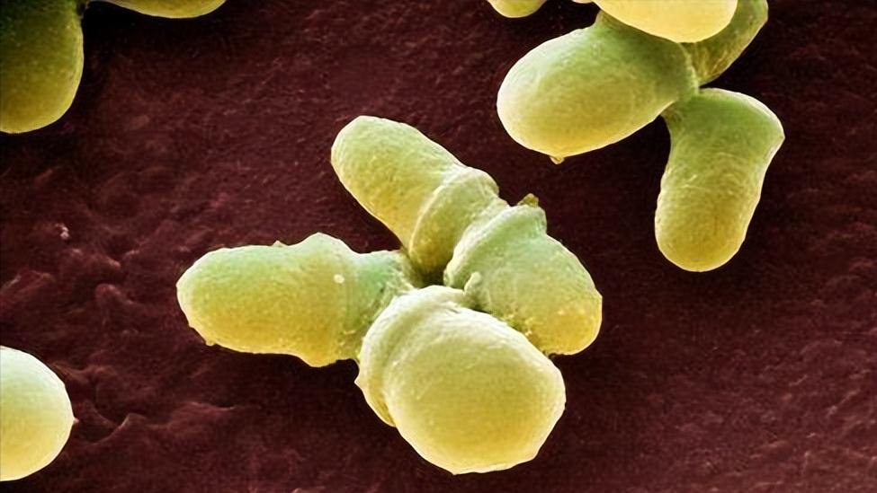 头皮总是长疙瘩或脓包是什么原因,头皮起脓包疙瘩是怎么回事