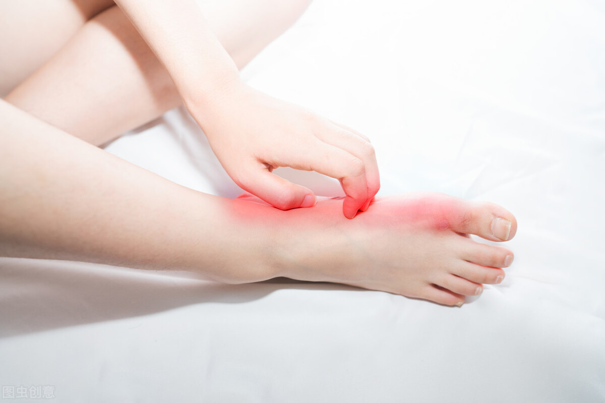 中国痛风诊疗指南原文,痛风诊疗指南2012