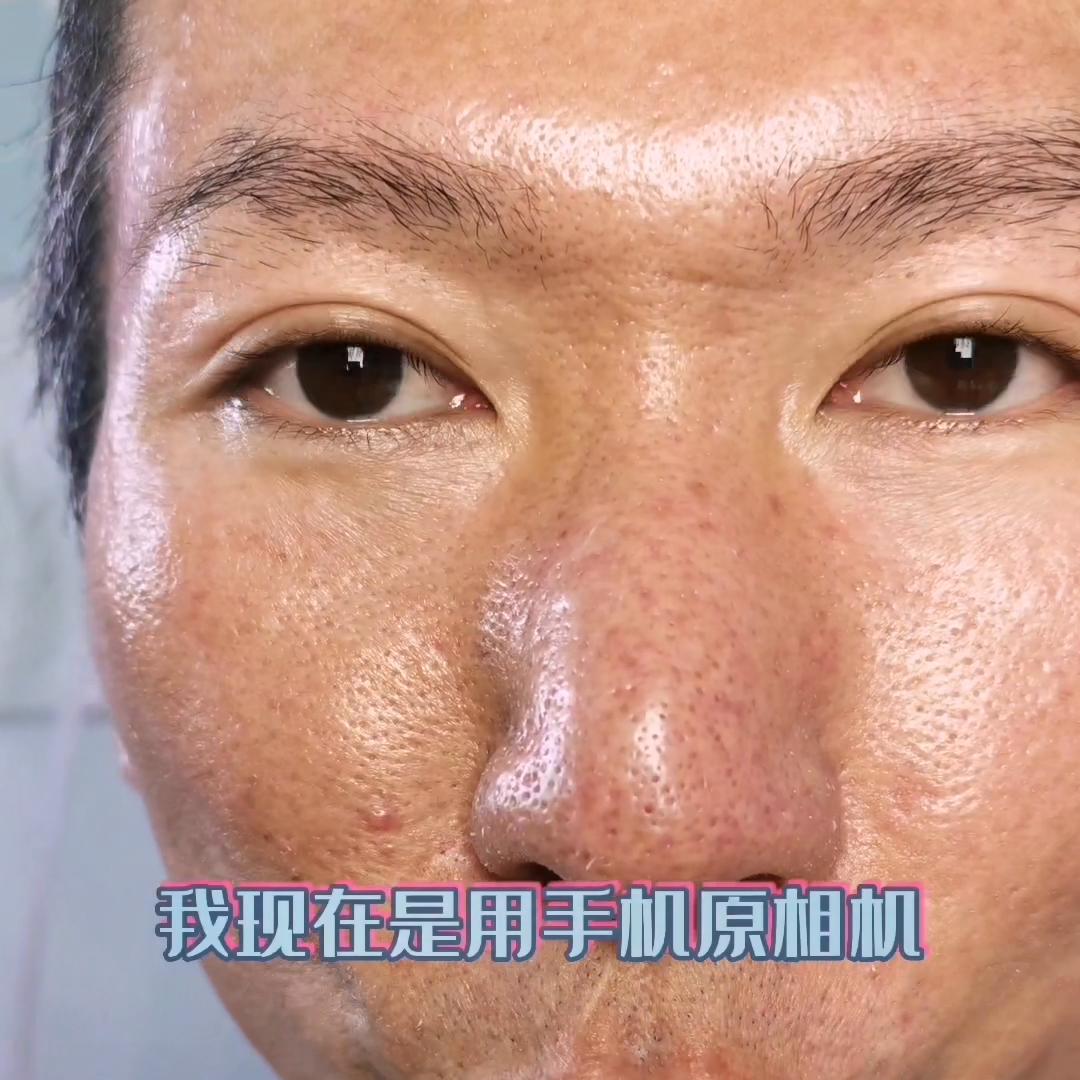 拯救毛孔大色斑敏感肌,拯救大毛孔4个方法