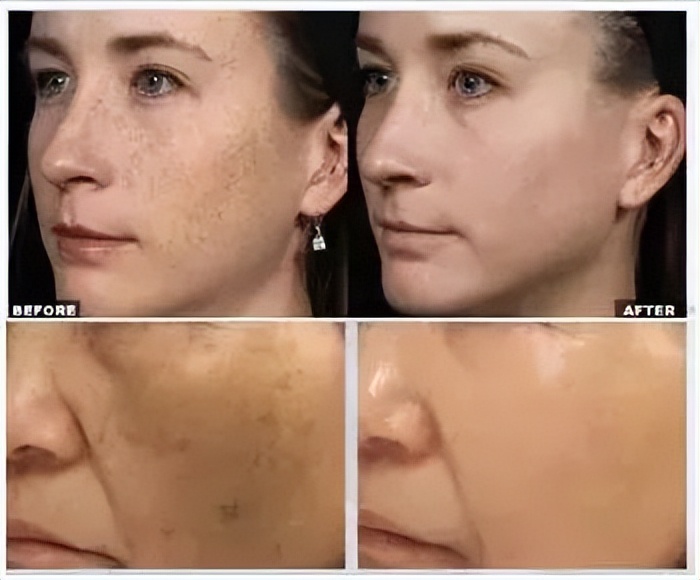 韩国东星小黑瓶祛斑霜，​韩国东星制药60年口碑企业出品！