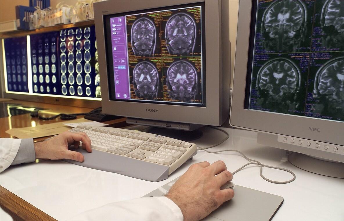 治愈精神类疾病的最有效手术,微创手术治疗精神疾病靠谱吗