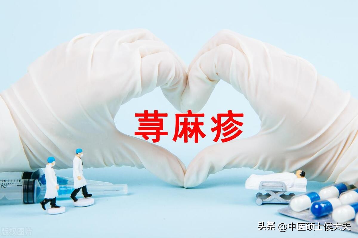 什么中药会引起过敏湿疹荨麻疹,治疗皮肤病麻疹的中草药