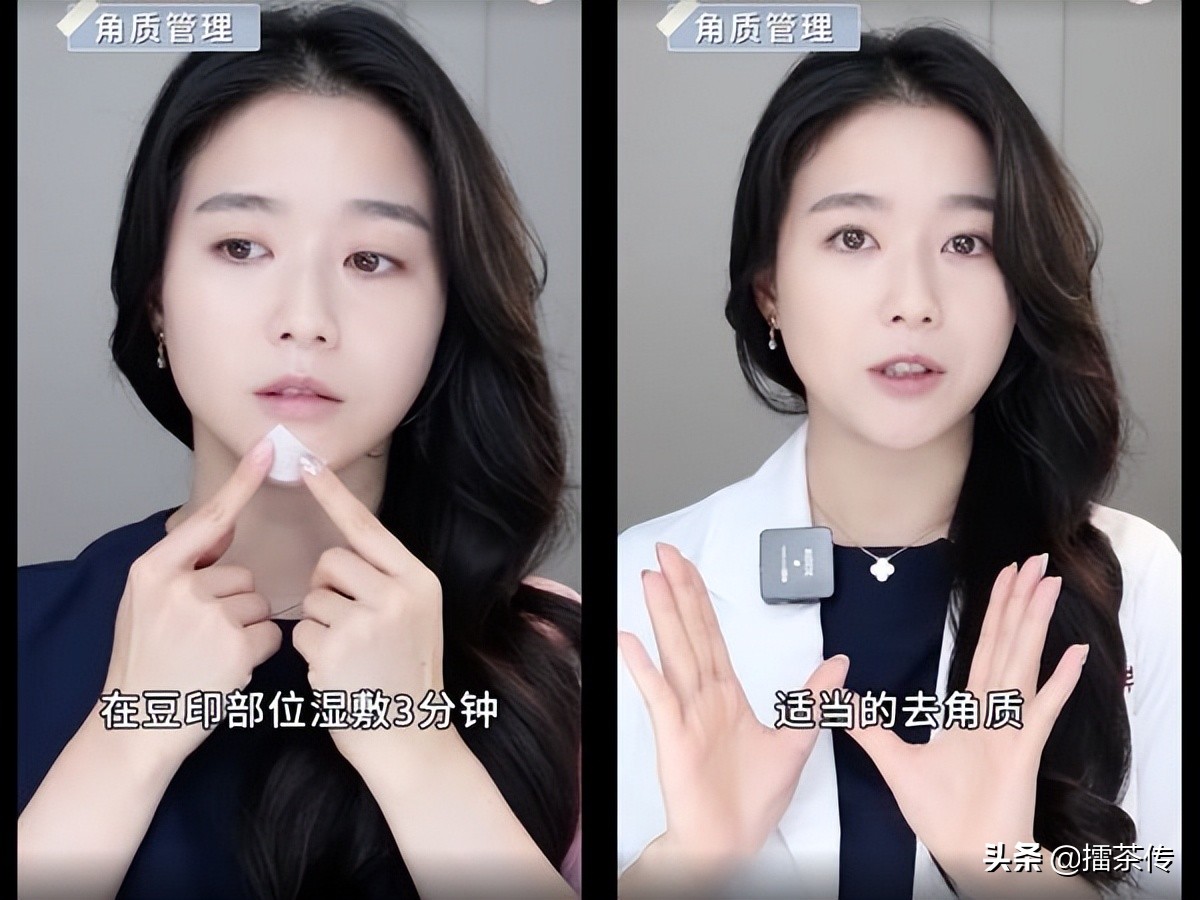 痘疤用什么药膏祛痘好用,痘疤脸怎么护肤