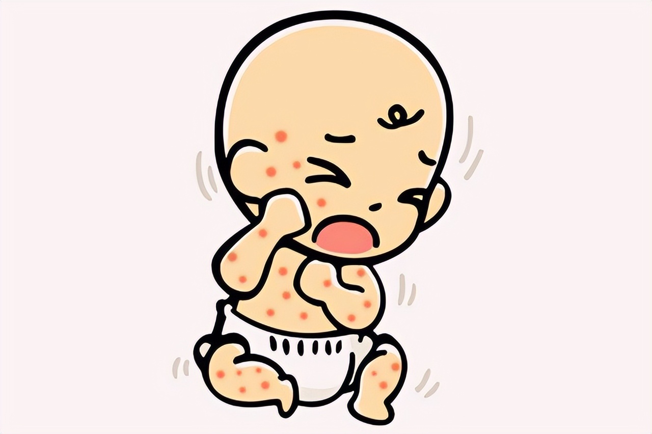 小孩下雨前手心长水泡,淋雨后手上透明水泡