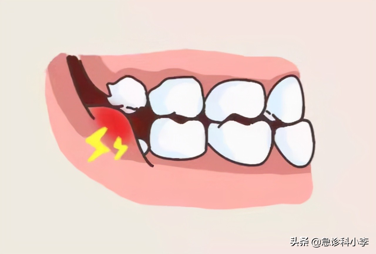 甲硝唑既便宜又好用，能治什么病？在这3种病中占有一席之地