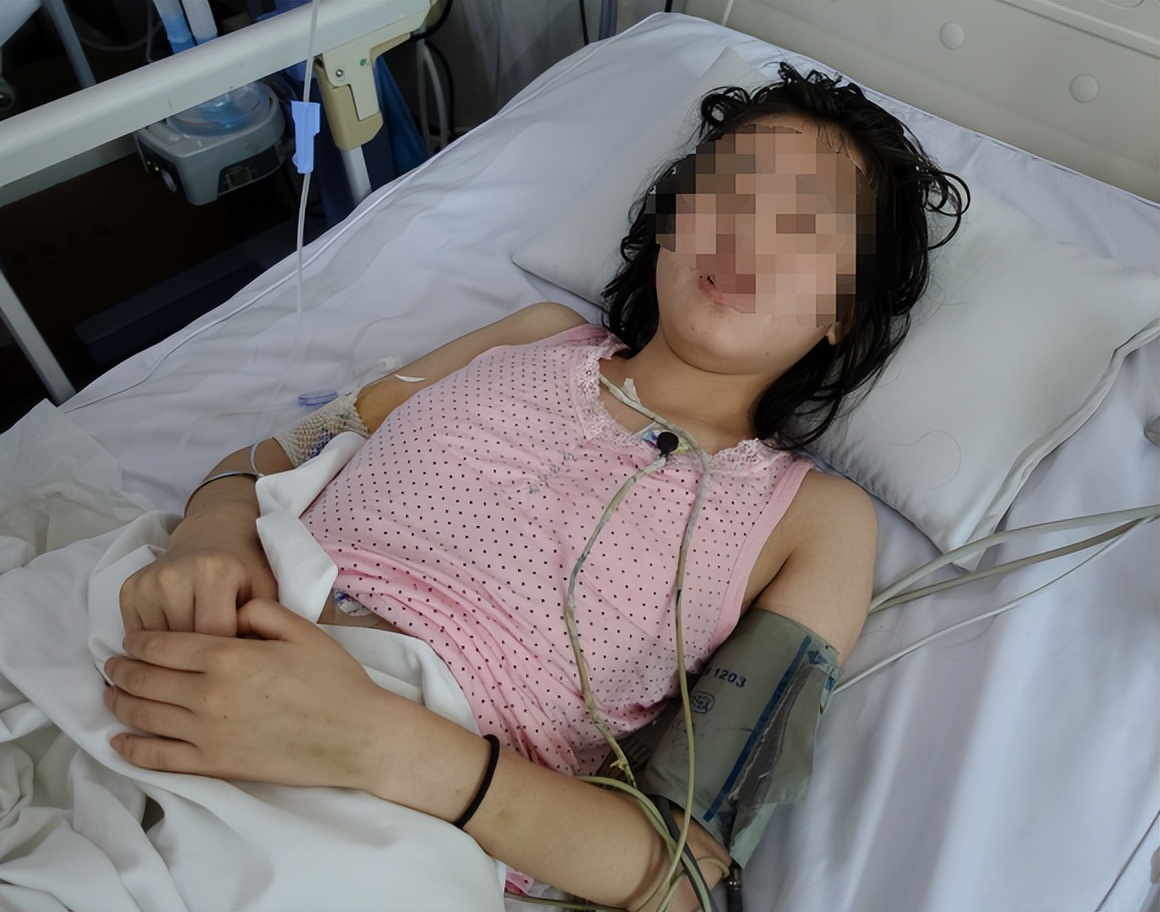 结核性脑积水能治愈吗,儿童结核脑膜炎脑积水