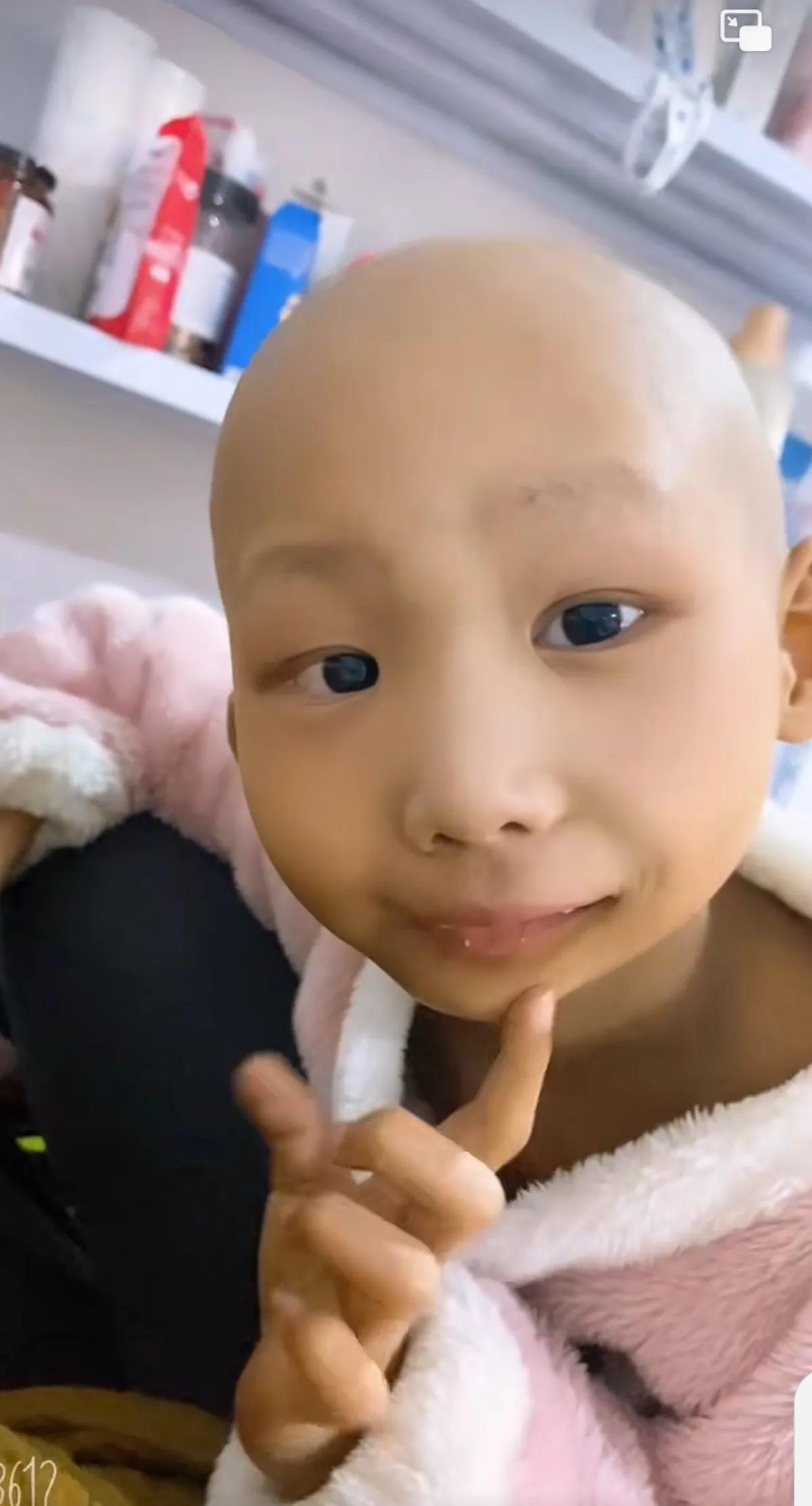 孩子腮腺淋巴结炎一直反复,儿童脸部淋巴结发炎一个大包