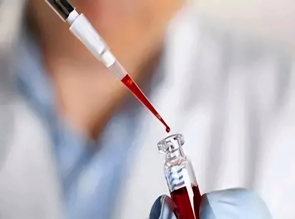 慢性炎症或可增加患癌风险，如何“消炎”？做好这7点