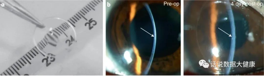 浜哄伐瑙掕啘瑙嗗姏鎭㈠,鐪肩潧澶辨槑鏇存崲浜哄伐瑙掕啘