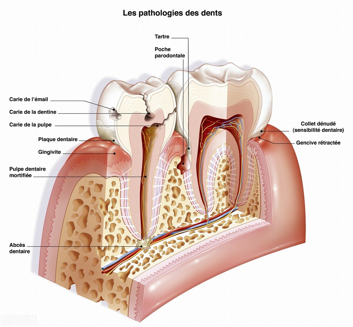 揭露牙科黑幕看牙到底贵在哪儿,看牙太贵有黑幕牙医教你省钱大招