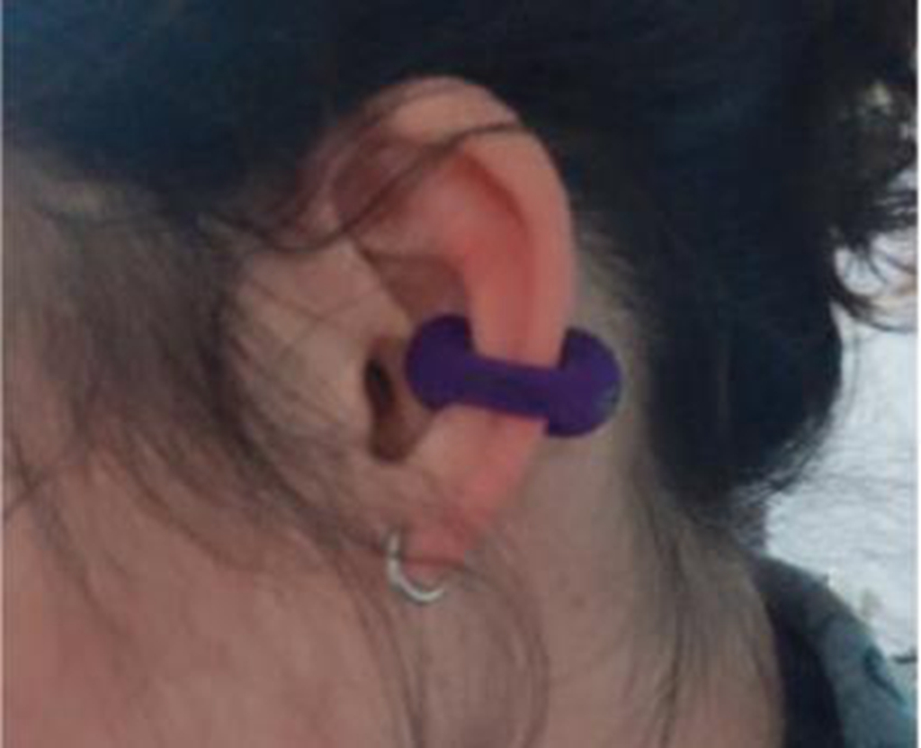 夹耳式骨传导和夹头式耳机哪个好,夹耳式骨传导蓝牙耳机真实测评