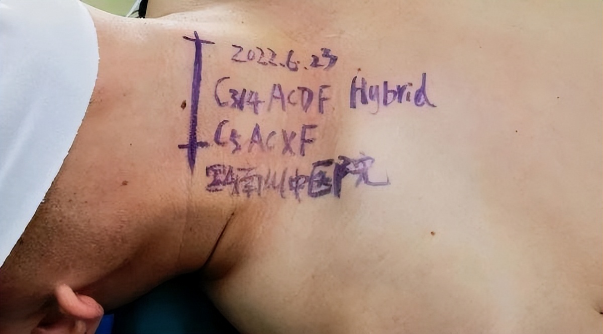 脊柱外科的最新突破,贵州中医二附院脊柱骨科