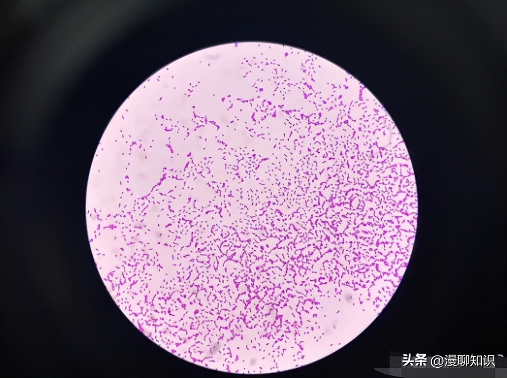 老年人得了肺炎应如何有效医治,肺炎有多严重怎么办