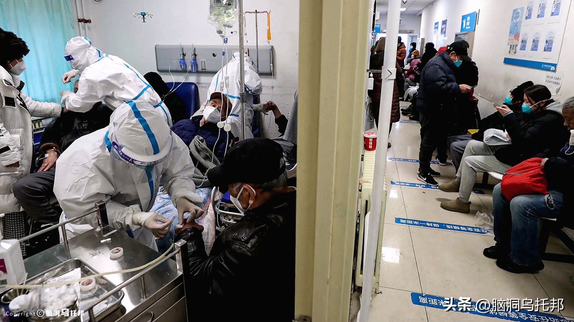 无症状感染是因为体质差吗,为什么有的人感染症状轻