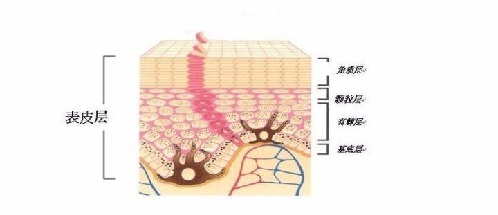 冬天身体干燥起皮屑怎么办穿什么,冬天一脱秋裤皮屑满天飞怎么办