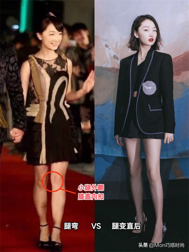 腿不直真的显腿粗吗,腿粗不是因为不够瘦是腿型不直