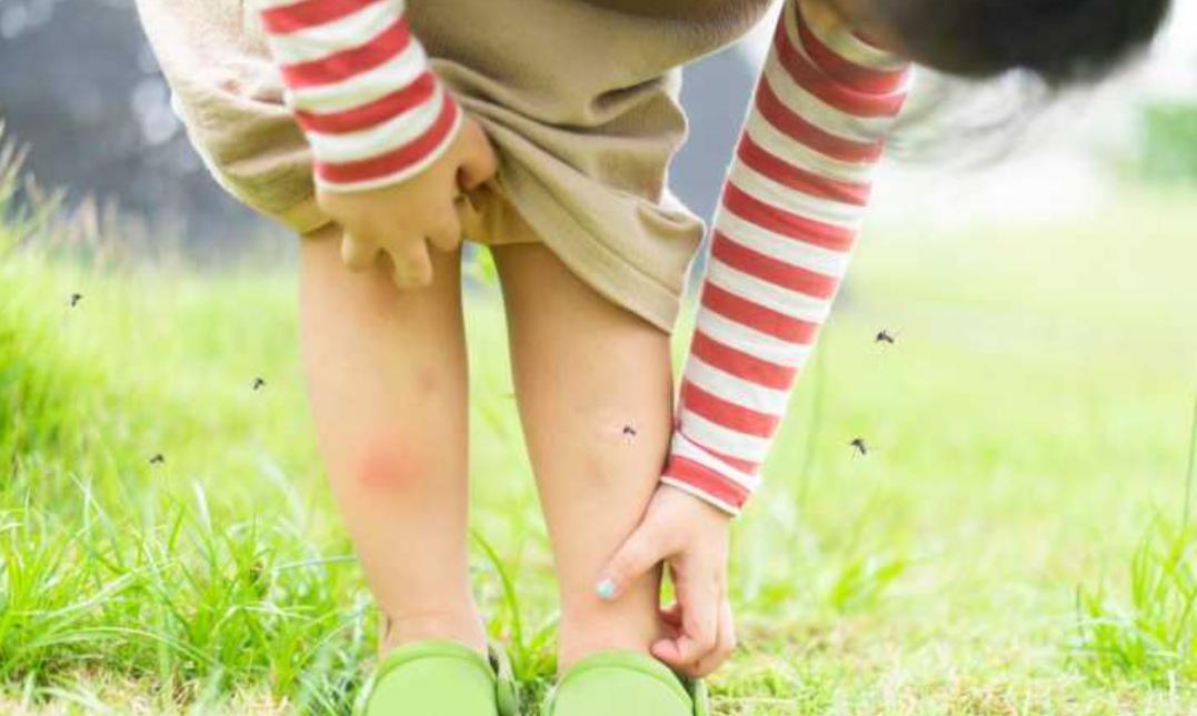 孩子被蚊子咬了老哭,孩子被蚊子咬过抓了红一片