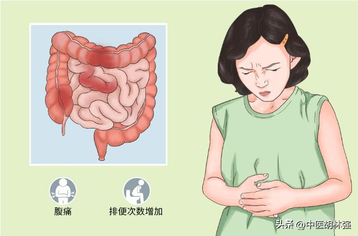 突然拉肚子没药怎么办,慢性腹泻可以吃氟哌酸吗