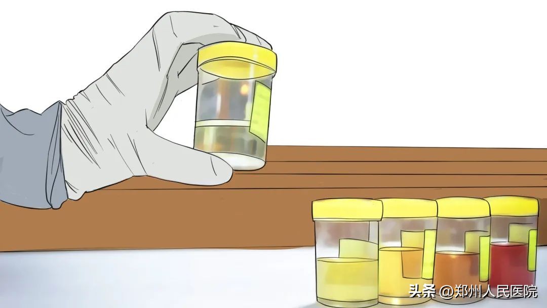 留尿这个“技术活”你还真不一定会！这篇有味道的文章我劝你看看