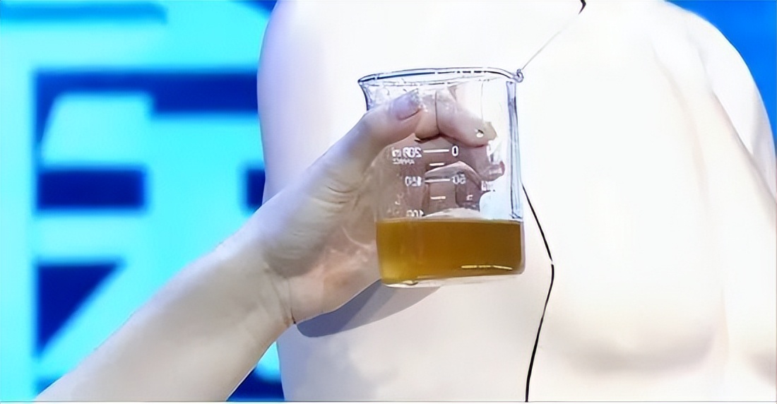 身体这四个地方发臭一定要注意,警惕身体出现7种异味八成患病