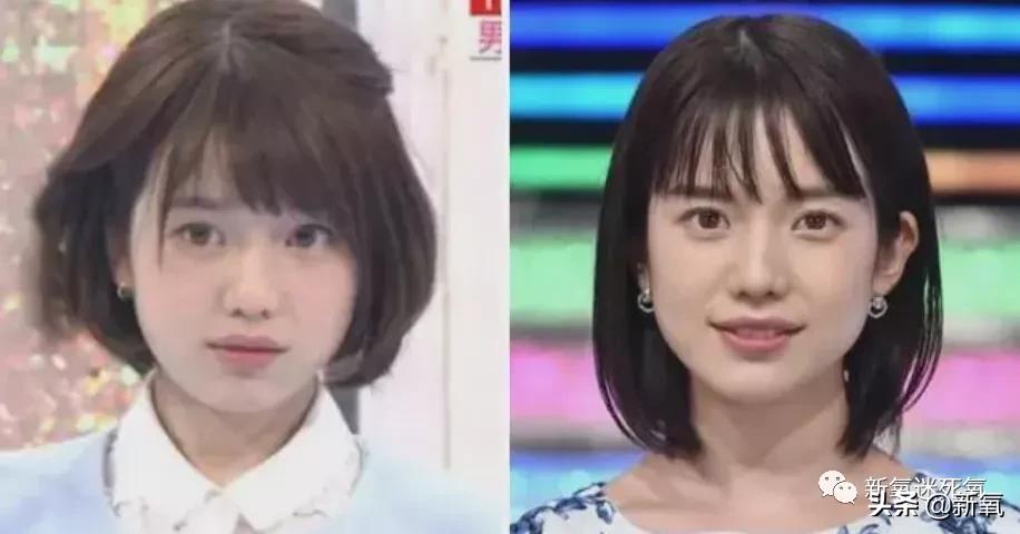 为什么整牙脸会小,为什么整牙期间脸会变老