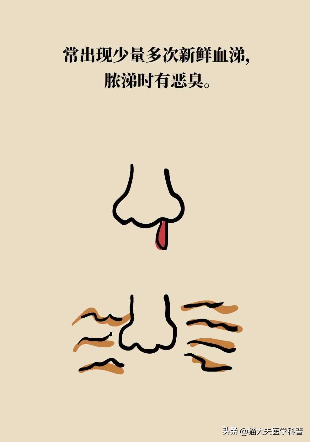 霉菌长什么样,鼻子里的霉菌图片