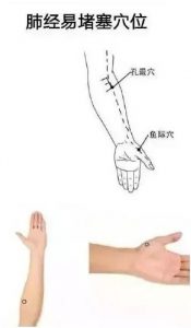 十二经络足阳明胃经穴位走向,胃部经络最易堵塞三个穴位