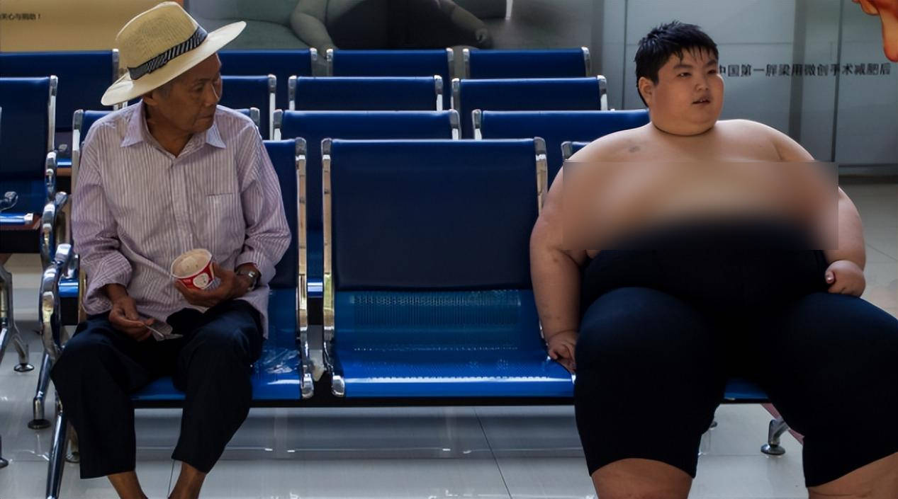 14岁300斤的小胖子,江西14岁少年体重300