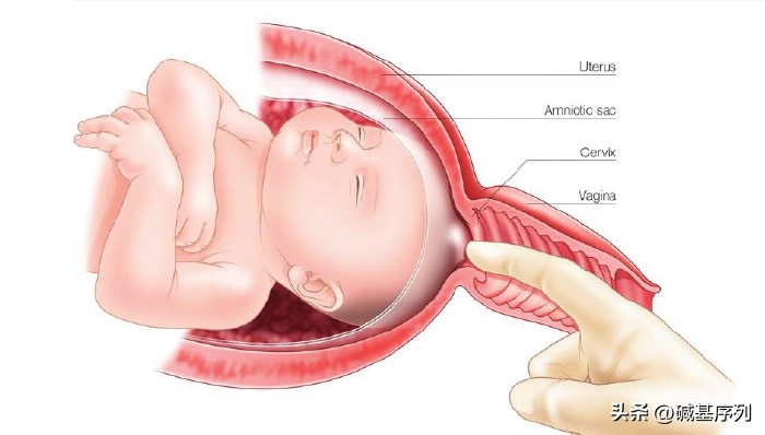 何时是妊娠晚期最佳引产时机?