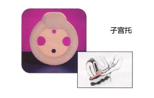 不肚疼有褐色出血会不会流产,怀孕不见红不腹痛会流产吗