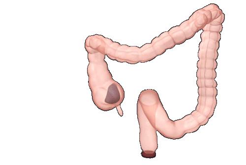 女孩子经常便秘的最快解决方法是,女生便秘解决的小妙招